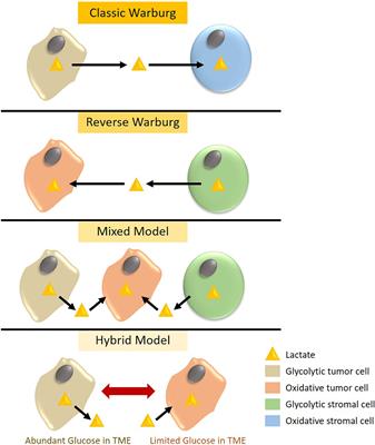 Lactate Metabolism and Immune Modulation in Breast Cancer: A Focused Review on Triple Negative Breast Tumors